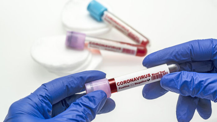 Шефката на болницата в Раднево е с коронавирус и е скрила за контактните си лица